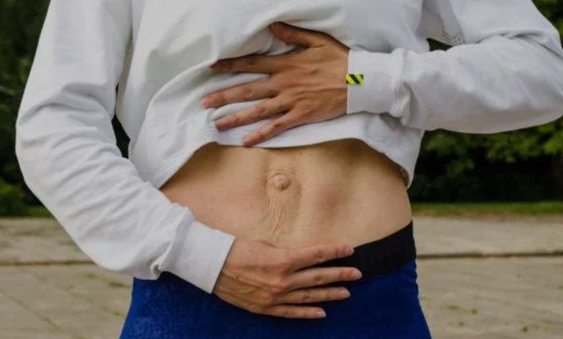 The Truth About Diastasis Recti: Why Closing the Gap Isn’t the Goal ...